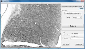 Figure 2. Graphical interface for processing brain cell images.