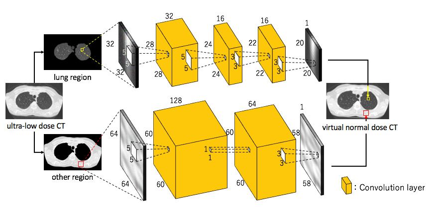 図 2. 超低線量 CT の肺の領域と肺以外の領域で学習した CNN 