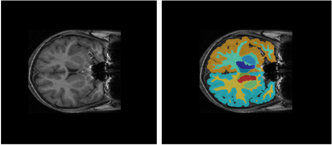 MRI image of the brain and ground truth segmentation mask of brain structures