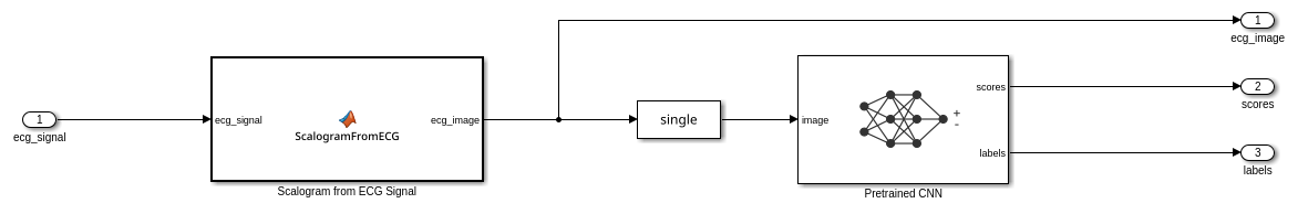 深層学習を使用した Simulink での ECG 信号の分類