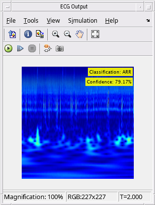 Classify ECG Signals in Simulink Using Deep Learning