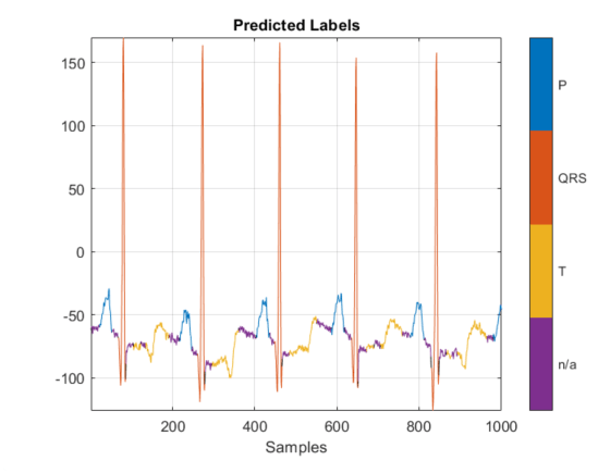 Deploy Signal Segmentation Deep Network on Raspberry Pi