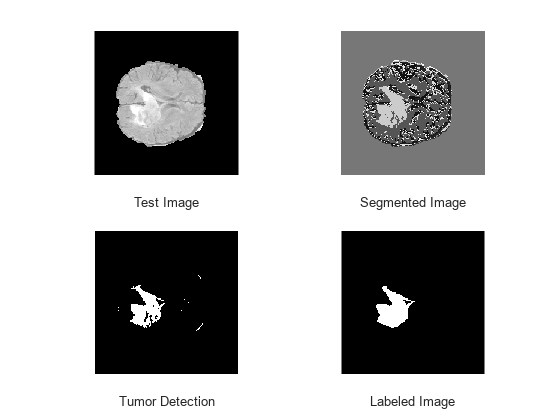 Figure contains 4 axes objects. Axes object 1 with xlabel Test Image contains an object of type image. Axes object 2 with xlabel Segmented Image contains an object of type image. Axes object 3 with xlabel Tumor Detection contains an object of type image. Axes object 4 with xlabel Labeled Image contains an object of type image.