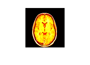 Figure contains an axes object. The axes object contains an object of type image.