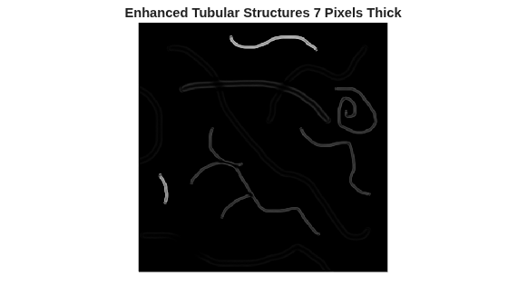 Figure contains an axes object. The hidden axes object with title Enhanced Tubular Structures 7 Pixels Thick contains an object of type image.