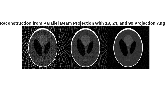 Figure contains an axes object. The hidden axes object with title Reconstruction from Parallel Beam Projection with 18, 24, and 90 Projection Angles contains an object of type image.