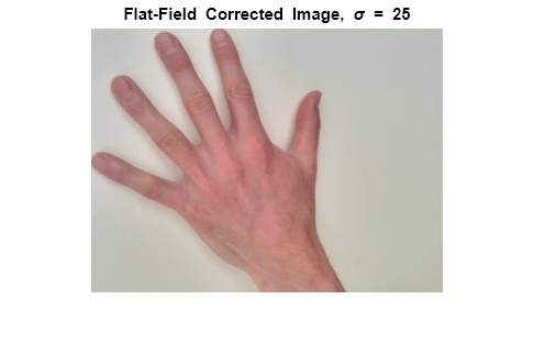 Figure contains an axes object. The axes object with title Flat-Field blank Corrected blank Image, blank sigma blank = 25 contains an object of type image.