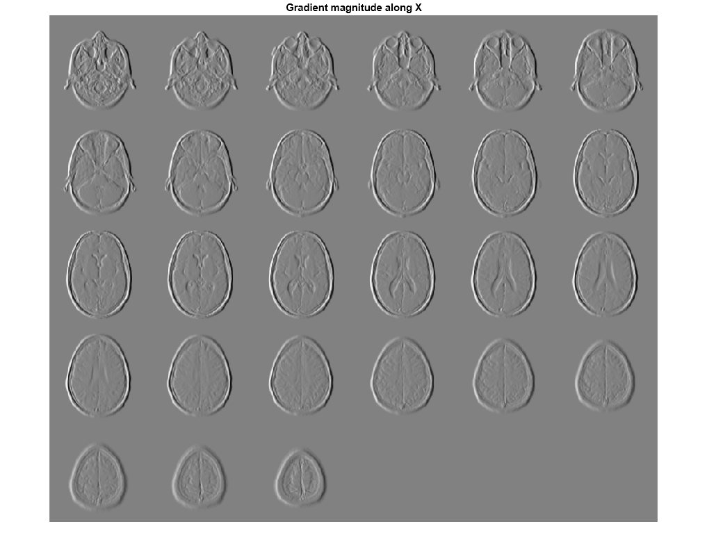 Figure contains an axes object. The axes object with title Gradient magnitude along X contains an object of type image.