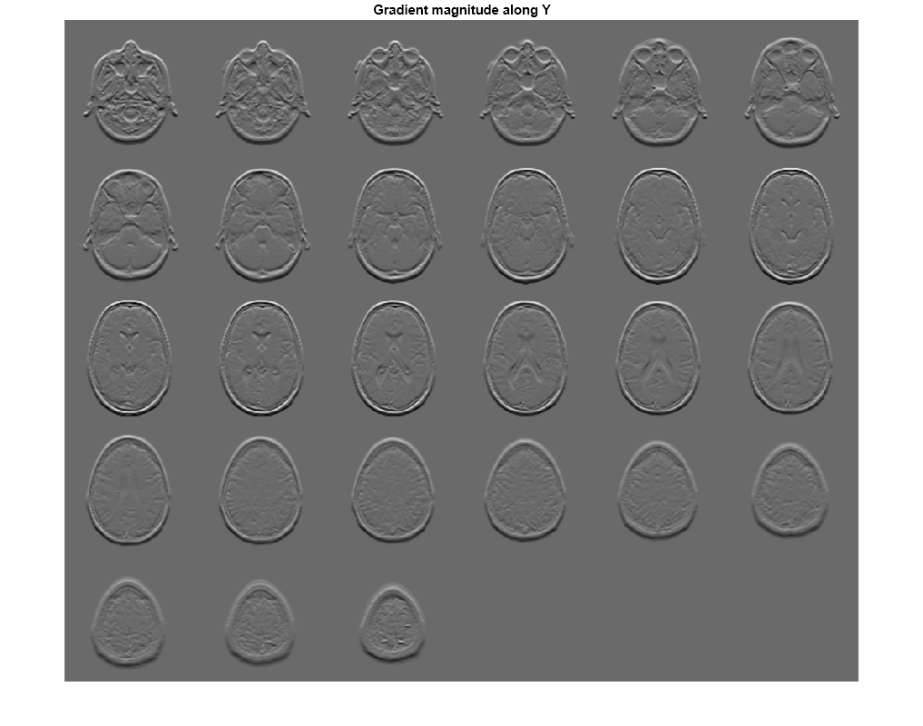 Figure contains an axes object. The axes object with title Gradient magnitude along Y contains an object of type image.