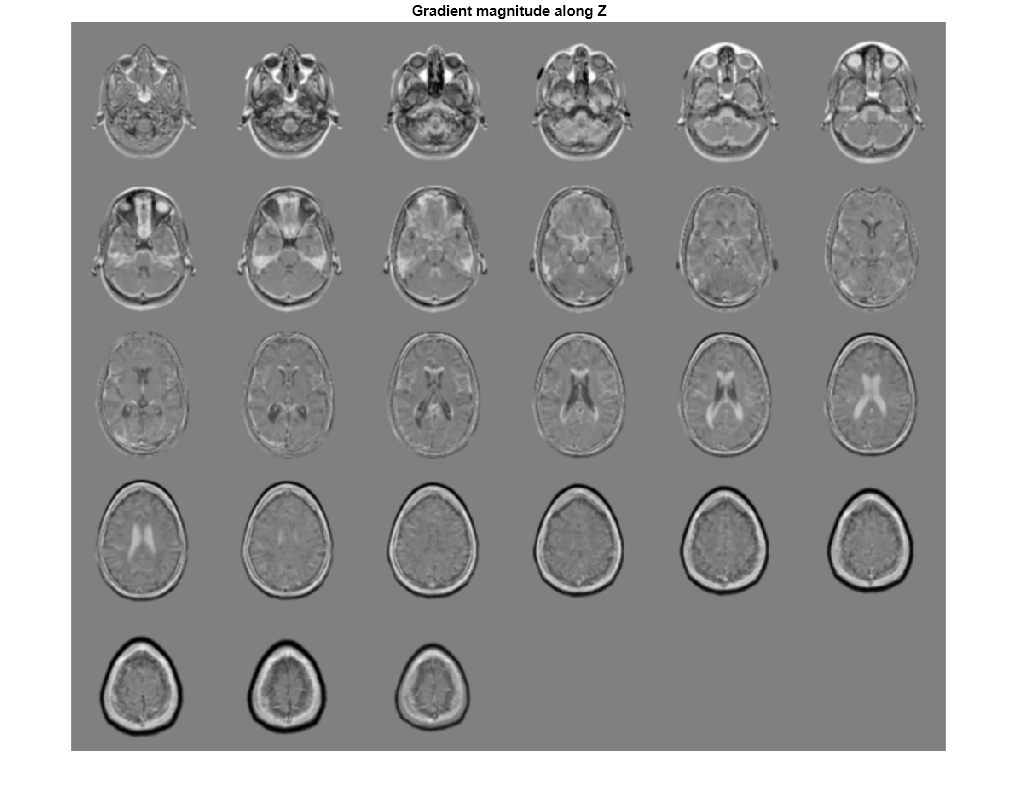 Figure contains an axes object. The axes object with title Gradient magnitude along Z contains an object of type image.