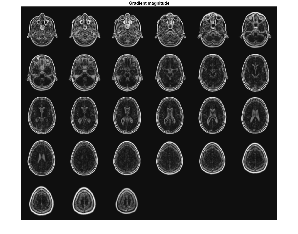 Figure contains an axes object. The axes object with title Gradient magnitude contains an object of type image.