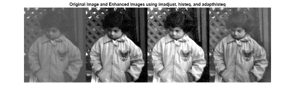 Figure contains an axes object. The axes object with title Original Image and Enhanced Images using imadjust, histeq, and adapthisteq contains an object of type image.