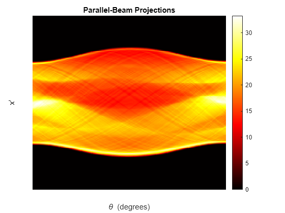 Figure contains an axes object. The axes object with title Parallel-Beam Projections, xlabel theta blank (degrees), ylabel x' contains an object of type image.