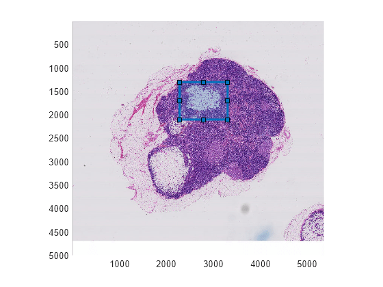 Figure contains an axes object. The axes object contains 2 objects of type bigimageshow, images.roi.rectangle.