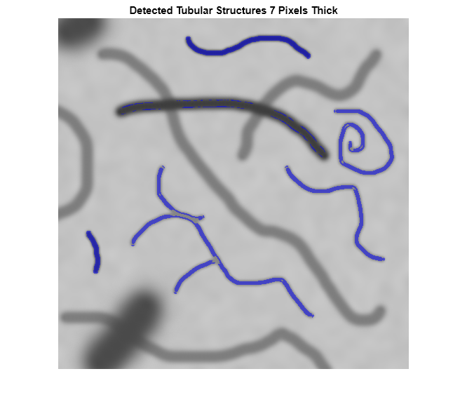 Figure contains an axes object. The axes object with title Detected Tubular Structures 7 Pixels Thick contains an object of type image.