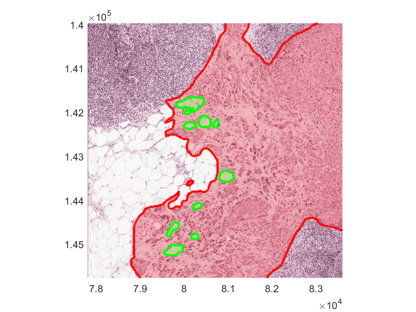 Preprocess Multiresolution Images for Training Classification Network