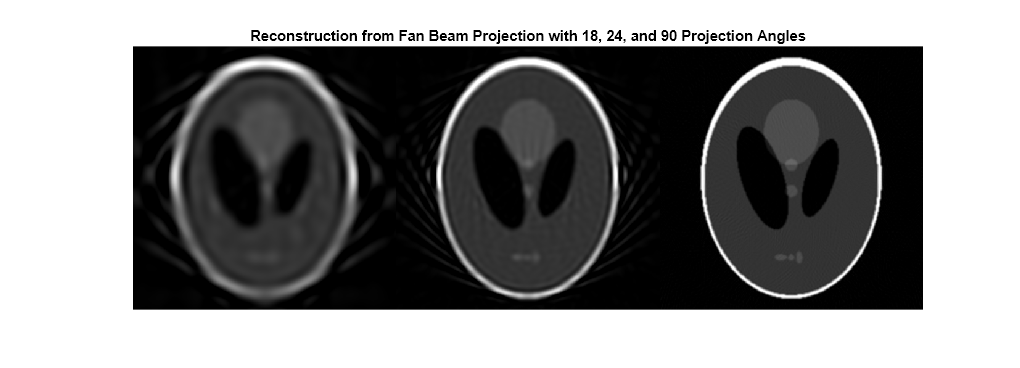 Figure contains an axes object. The axes object with title Reconstruction from Fan Beam Projection with 18, 24, and 90 Projection Angles contains an object of type image.