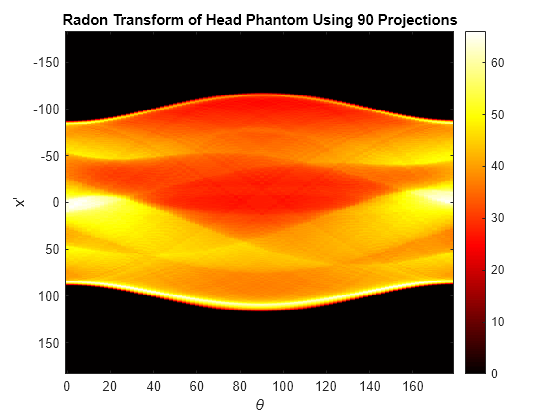 Figure contains an axes object. The axes object with title Radon Transform of Head Phantom Using 90 Projections, xlabel theta, ylabel x prime contains an object of type image.