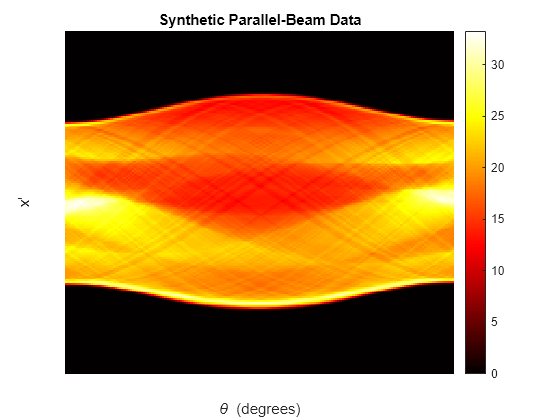 Figure contains an axes object. The axes object with title Synthetic Parallel-Beam Data, xlabel theta blank (degrees), ylabel x' contains an object of type image.