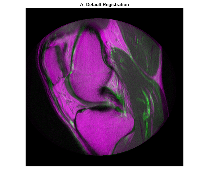 Figure contains an axes object. The axes object with title A: Default Registration contains an object of type image.