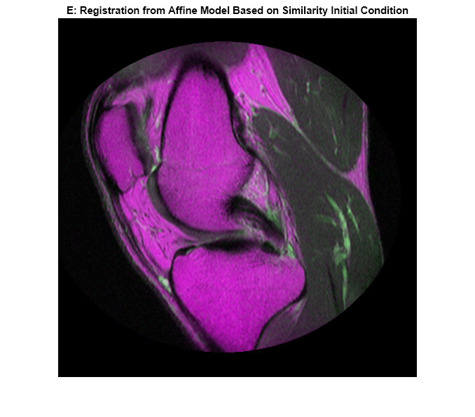 Figure contains an axes object. The axes object with title E: Registration from Affine Model Based on Similarity Initial Condition contains an object of type image.