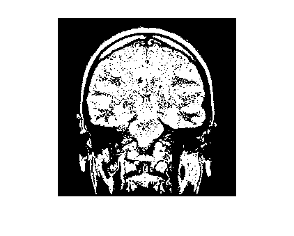 Figure contains an axes object. The axes object contains an object of type image.