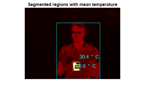 Figure contains an axes object. The axes object with title Segmented regions with mean temperature contains 5 objects of type image, rectangle, text.