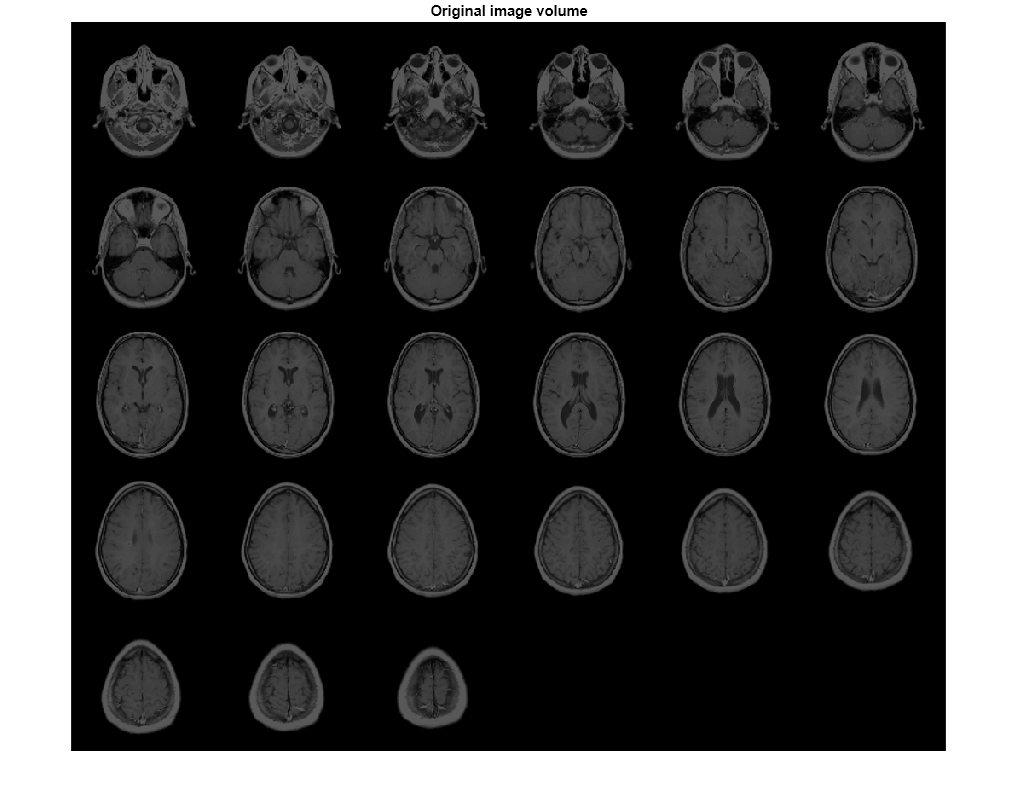 Figure contains an axes object. The axes object with title Original image volume contains an object of type image.