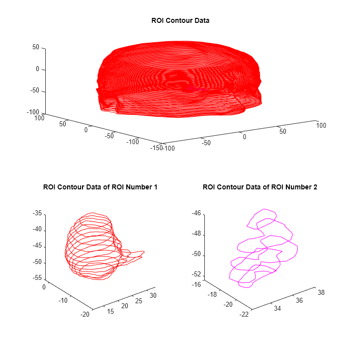 Figure contains 3 axes objects. Axes object 1 with title ROI Contour Data contains 109 objects of type line. Axes object 2 with title ROI Contour Data of ROI Number 1 contains 13 objects of type line. Axes object 3 with title ROI Contour Data of ROI Number 2 contains 5 objects of type line.