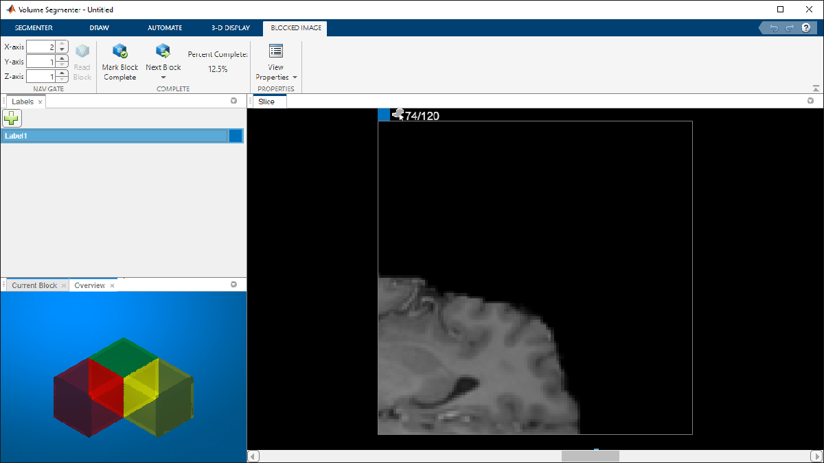UsingVolSegWithBlockedImagesExample_07.png