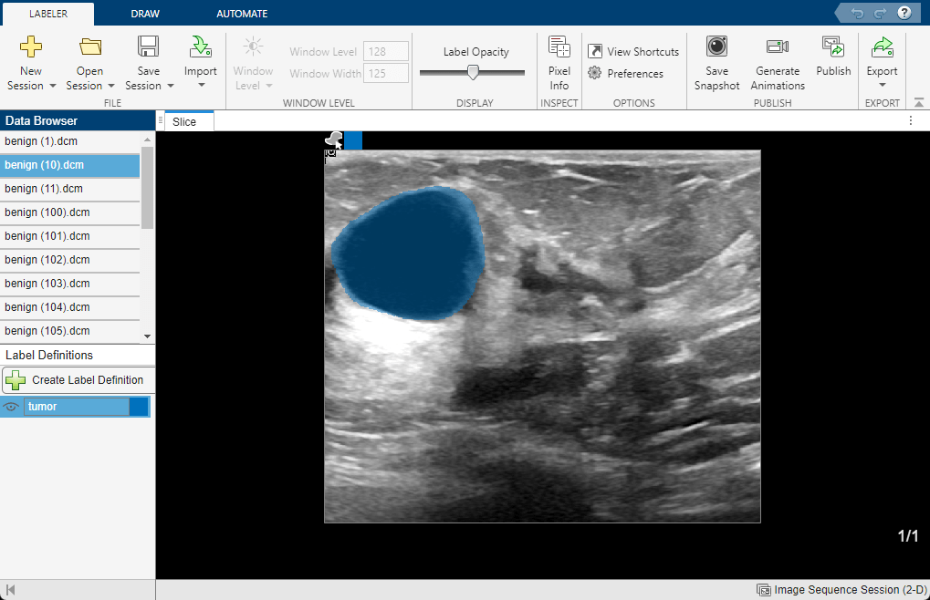 Medical Image Labeler app window showing the second label image, which was generated outside the app