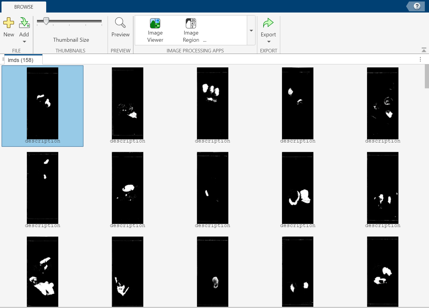 Image Browser app window showing thumbnails of the tissue masks for the normal whole slide images