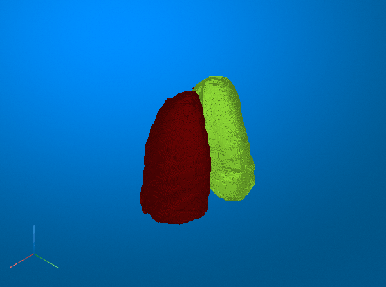 Segment Lungs from CT Scan Using Pretrained Neural Network
