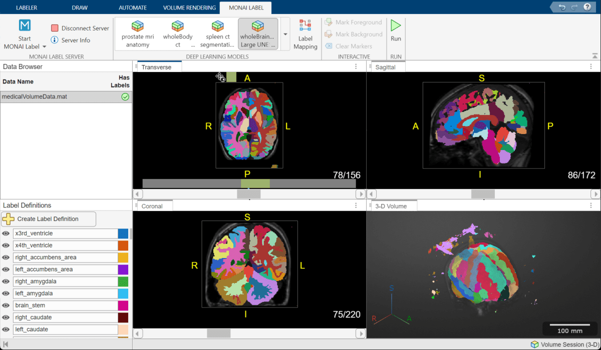 Medical Image Labeler app window with brain labels predicted using MONAI Label