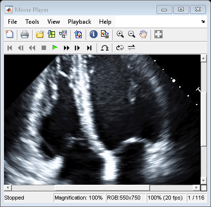 Figure Movie Player contains an axes object and other objects of type uiflowcontainer, uimenu, uitoolbar. The hidden axes object contains an object of type image.