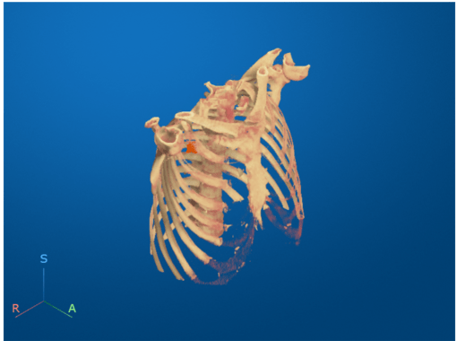 Viewer window showing drawn polygon around the bed region to remove