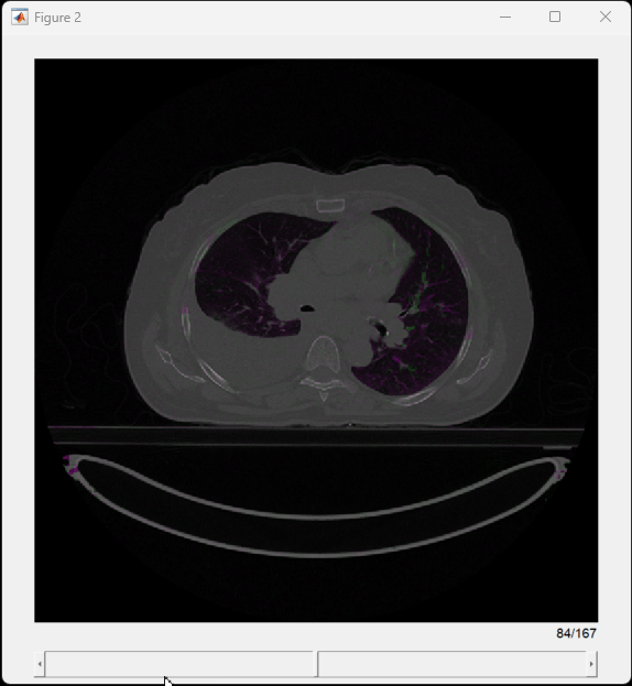 Scrollable sliceViewer window showing the transverse slices of a fused overlay of the registered volumes.