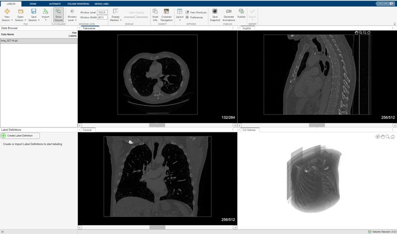 Data loaded in Medical Image Labeler