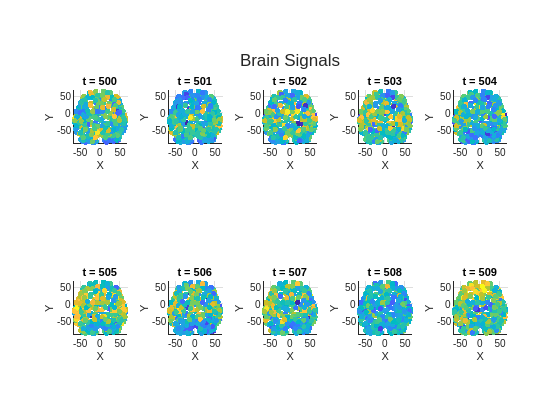 Graph Signal Processing and Brain Signal Analysis - MATLAB & Simulink ...