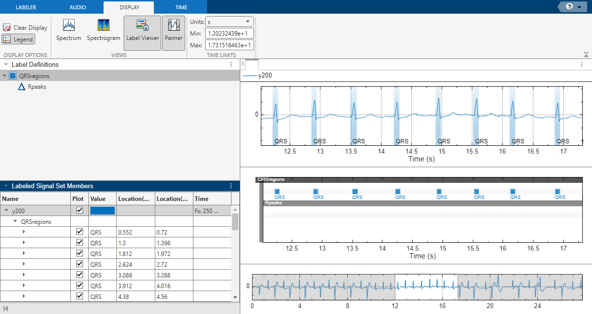 signalLabeler_ecgsignals2_22a.png