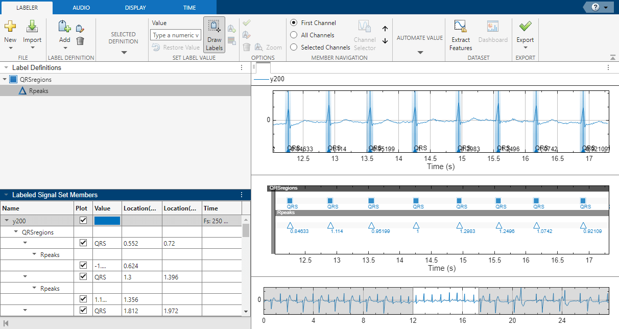 signalLabeler_ecgsignals3_22a.png