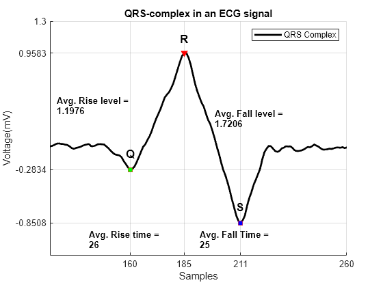 Figure contains an axes object. The axes object with title QRS-complex in an ECG signal, xlabel Samples, ylabel Voltage(mV) contains 11 objects of type line, text. One or more of the lines displays its values using only markers These objects represent QRS-Complex, Peak, Minima.