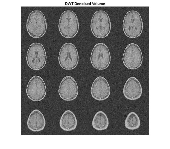 Figure contains an axes object. The axes object with title DWT Denoised Volume contains an object of type image.