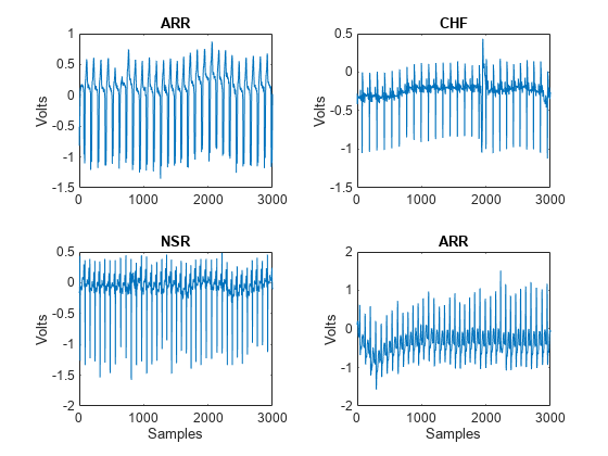 Figure contains 4 axes objects. Axes object 1 with title ARR, ylabel Volts contains an object of type line. Axes object 2 with title CHF, ylabel Volts contains an object of type line. Axes object 3 with title NSR, xlabel Samples, ylabel Volts contains an object of type line. Axes object 4 with title ARR, xlabel Samples, ylabel Volts contains an object of type line.