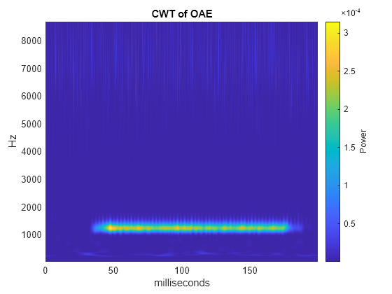 Figure contains an axes object. The axes object with title CWT of OAE, xlabel milliseconds, ylabel Hz contains an object of type surface.