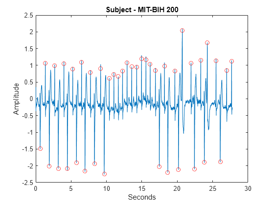 Figure contains an axes object. The axes object with title Subject - MIT-BIH 200, xlabel Seconds, ylabel Amplitude contains 2 objects of type line. One or more of the lines displays its values using only markers