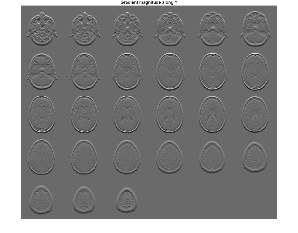 Figure contains an axes object. The hidden axes object with title Gradient magnitude along Y contains an object of type image.