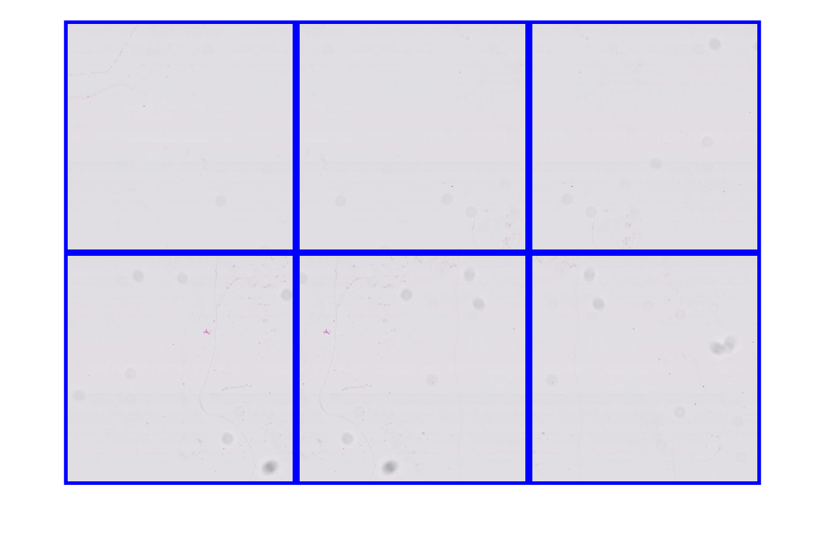 Figure contains an axes object. The hidden axes object contains an object of type image.