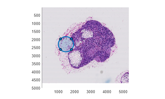Figure contains an axes object. The axes object contains 2 objects of type bigimageshow, images.roi.circle.