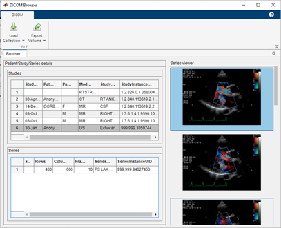 Dicom ファイルのコレクションの探索 Matlab Mathworks 日本